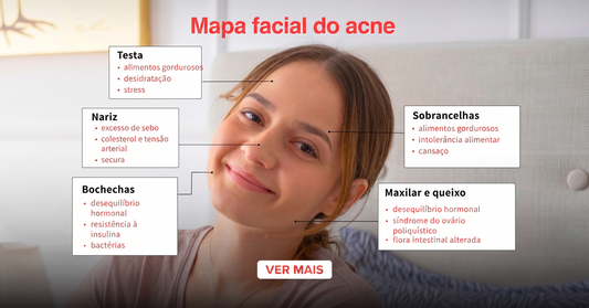 Mapa do rosto na acne, por zona