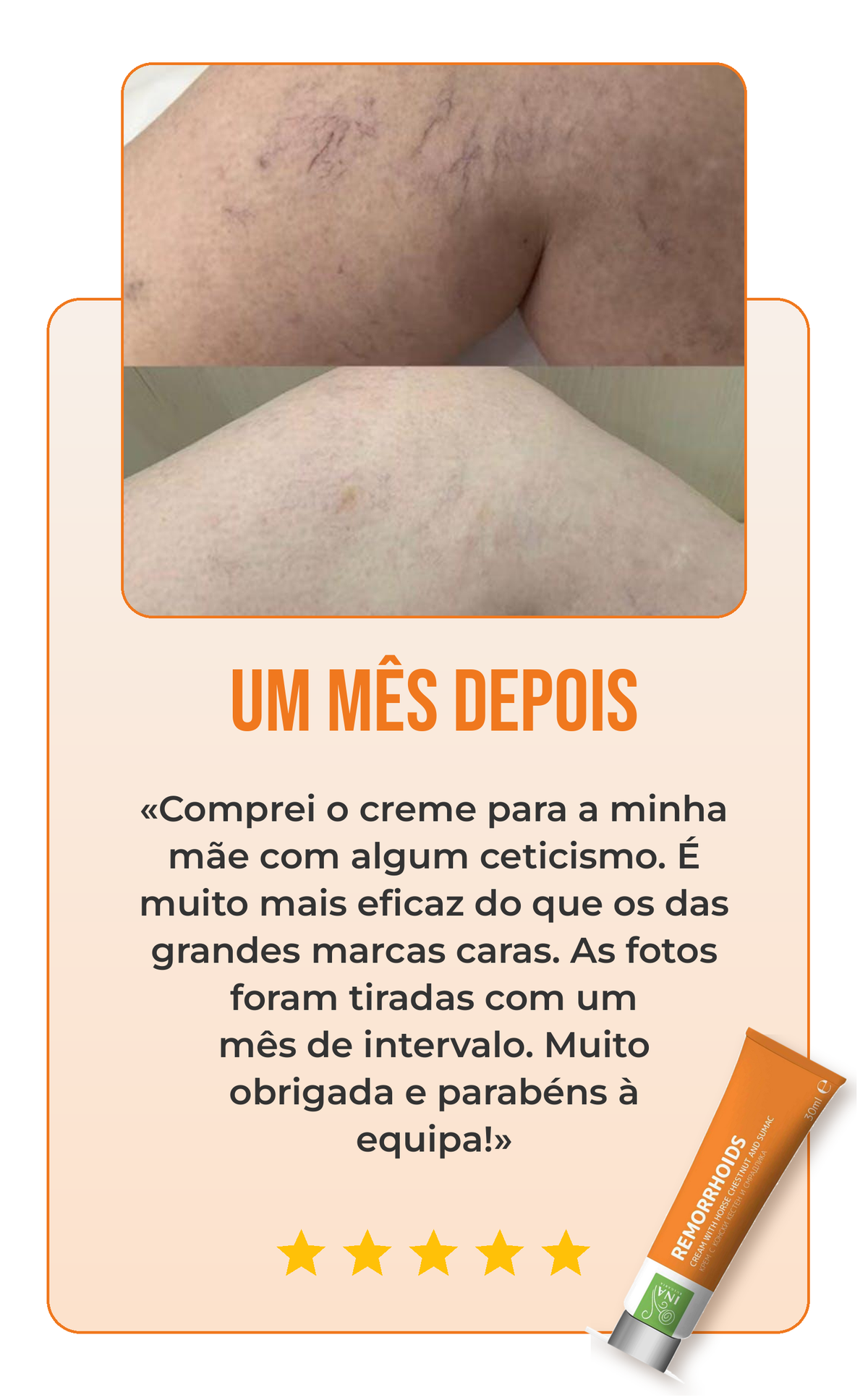 Avaliação creme para varizes 1