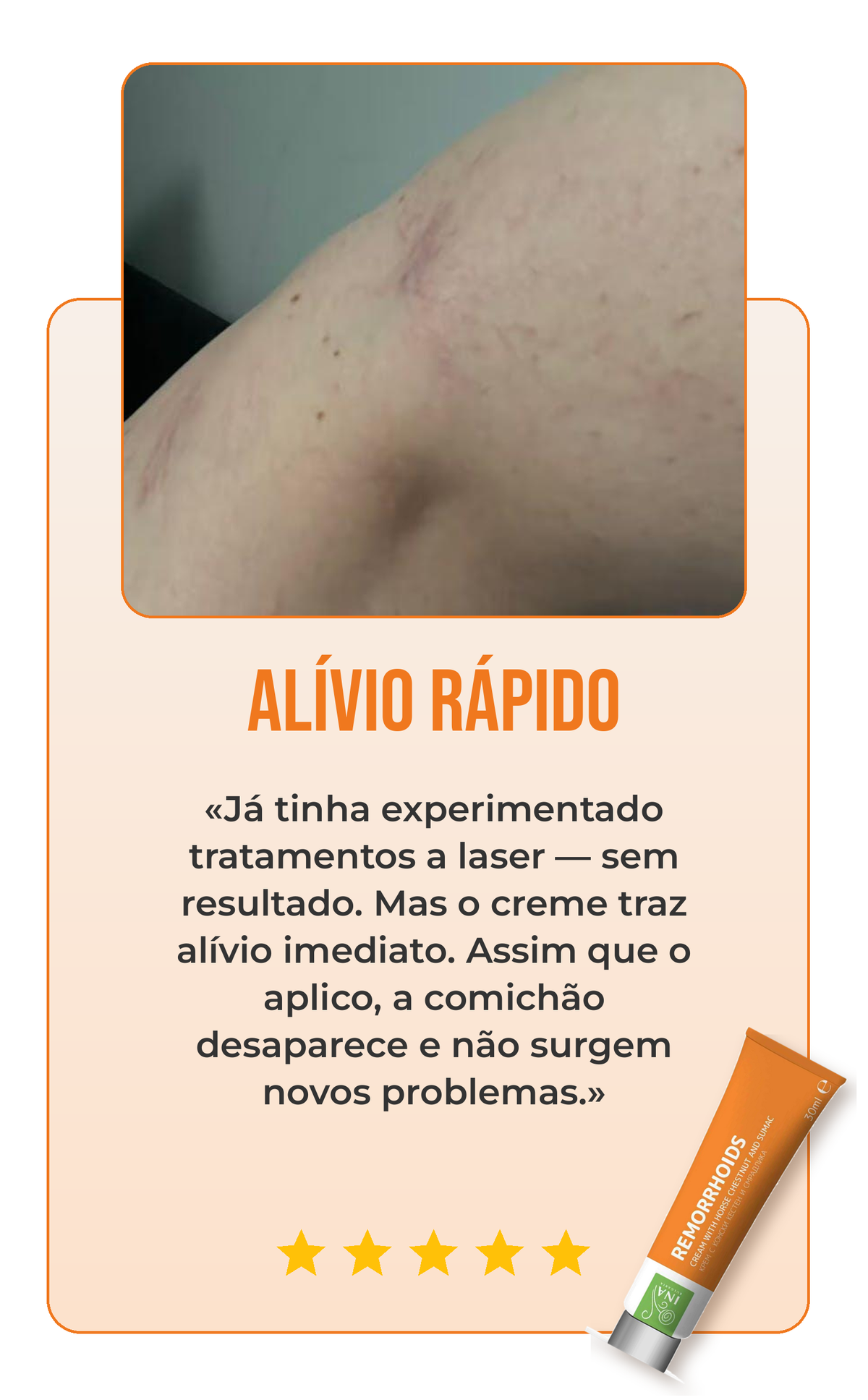 Avaliação creme para varizes 3