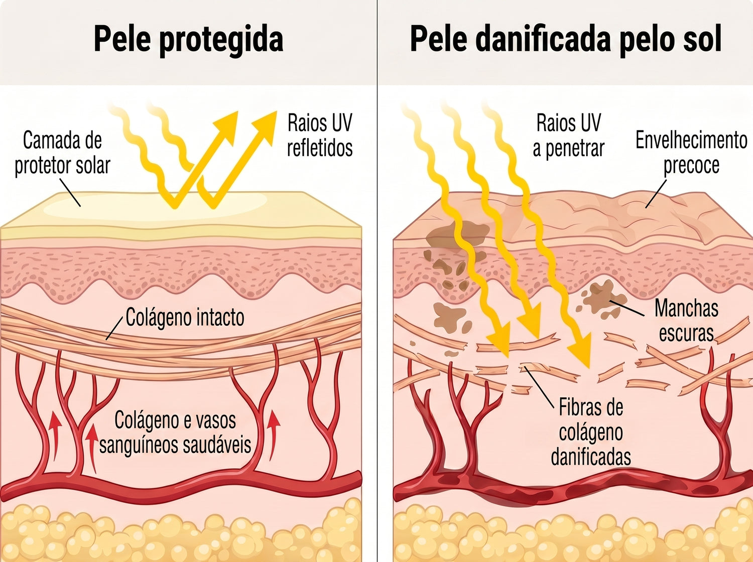spf PT infographic